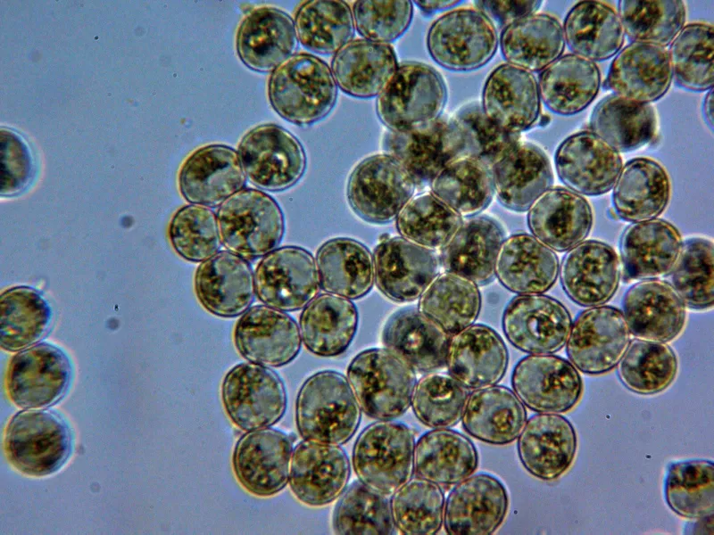 Amanita submembranacea 10 - Esporas Melzer inamiloides